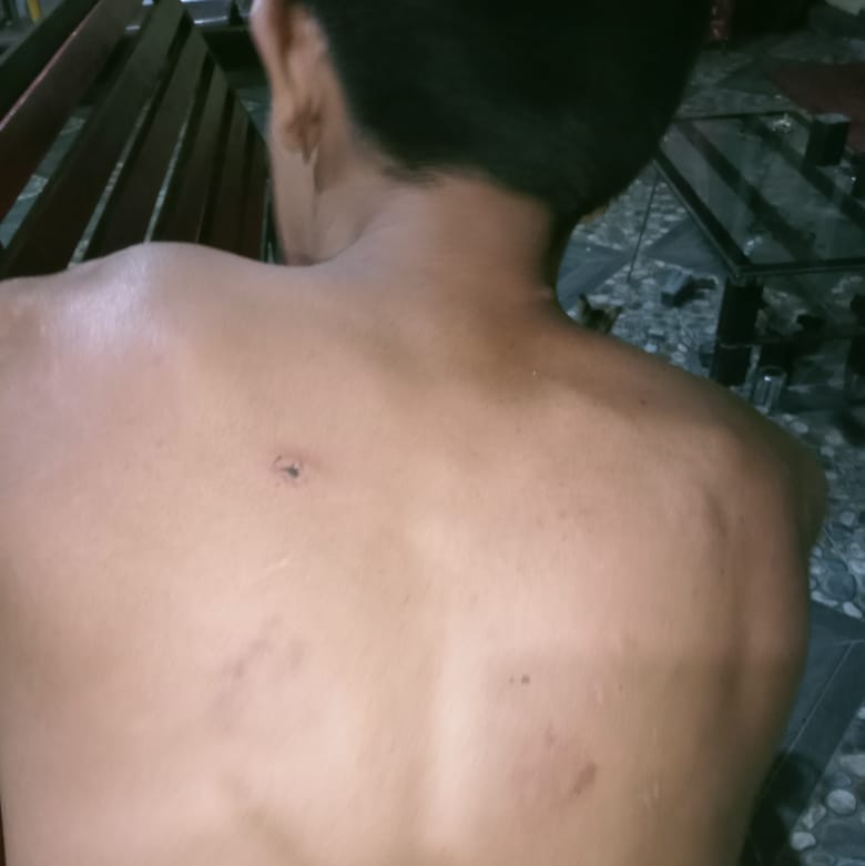 Adeknya Dianiaya Warga, Seorang Kakak Buat Laporan Ke Polisi