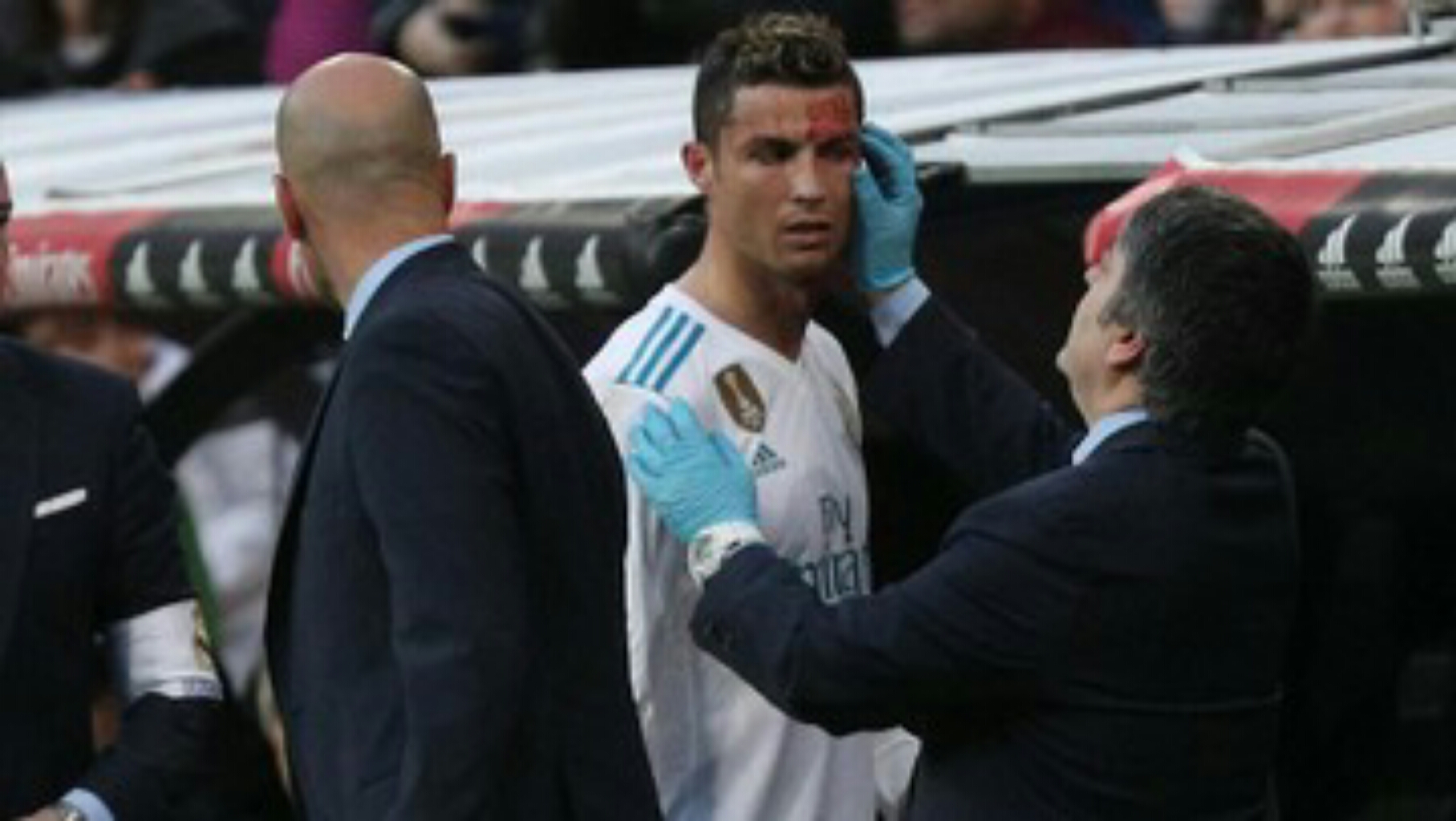 Zidane: Ronaldo Hanya Butuh Tiga Jahitan di Kepala