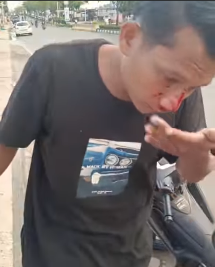 Diterpa Hujan Dan Angin Kencang, Ranting Pohon Timpa Dua Pengendara Di Rokan Hulu