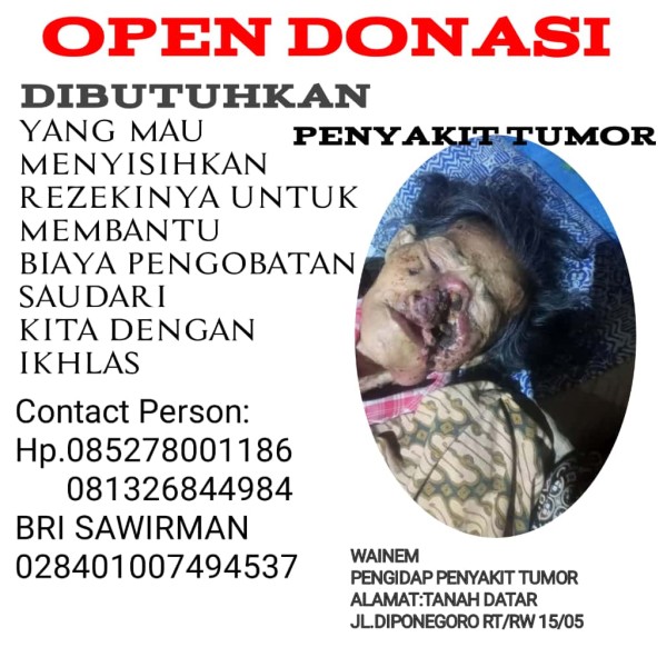 Kisah Pilu Ibu Wainem di Inhu, Derita Tumor Ganas yang Membutuhkan Uluran Tangan Dermawan