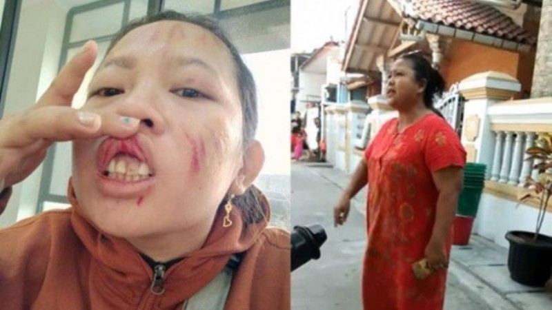 Viral!! Tanya Soal Sembako, Seorang Ibu di Jakarta Dihajar Istri RT Hingga Babak Belur dan Bonyok